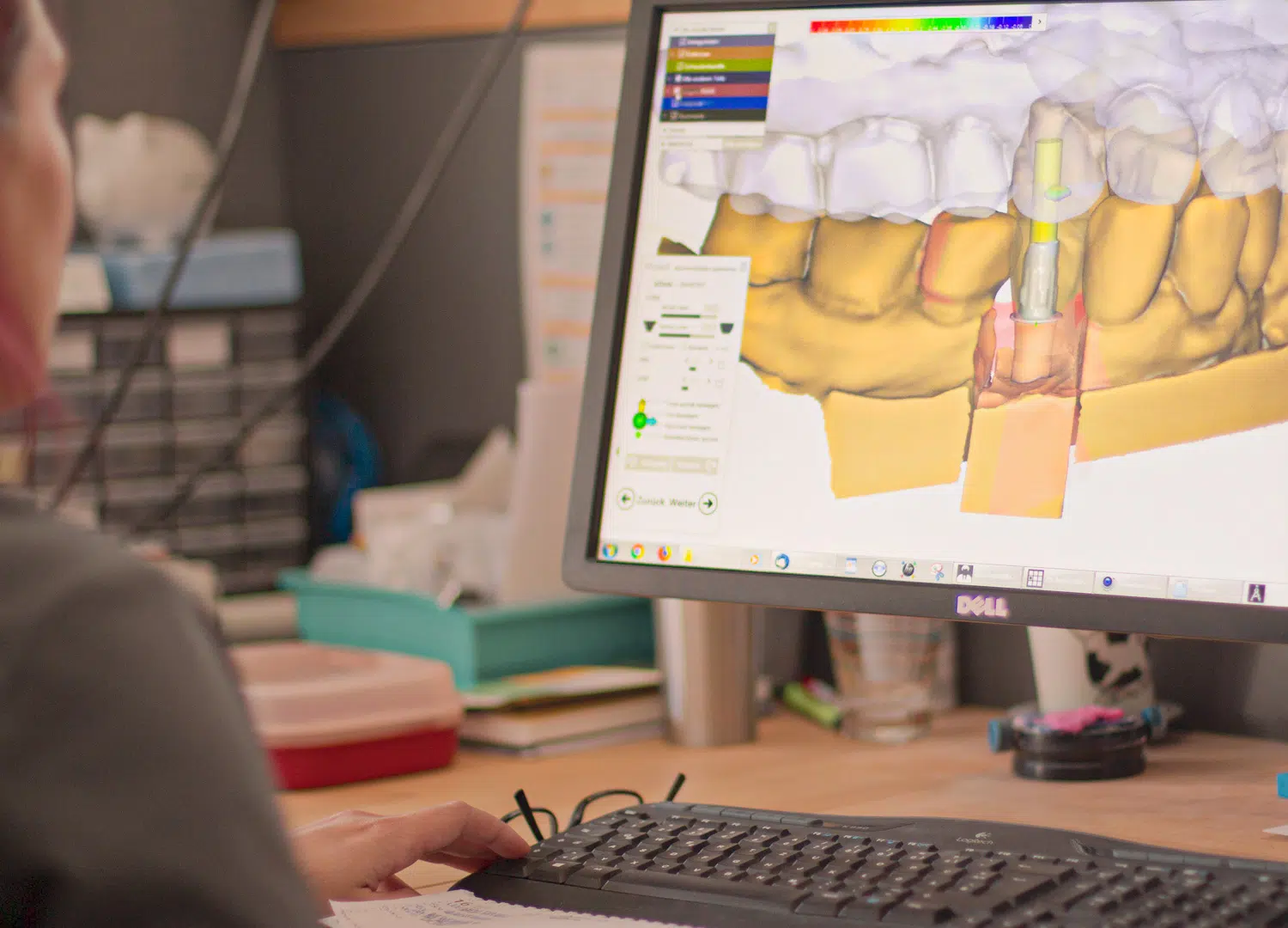 3D-Scanner im Dentallabor